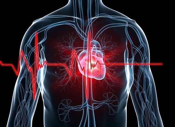 Demand Ischemia