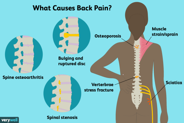 Back Pain