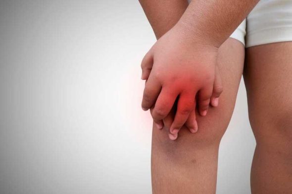 Childhood Arthritis