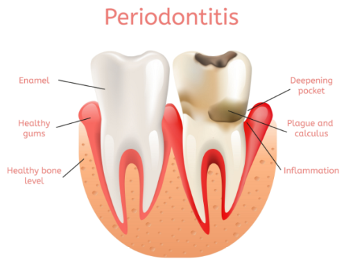 Periodontist