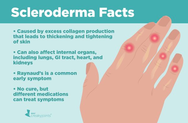 Scleroderma