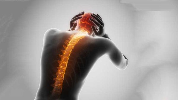 Spinal Headaches