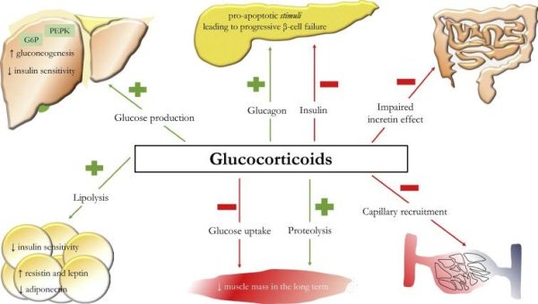 Steroid Induced Diabetes