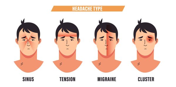 Tension Headaches