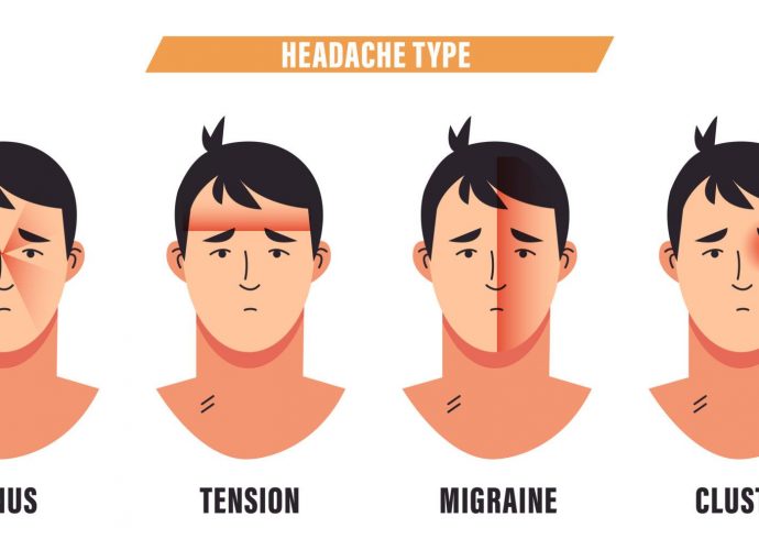 Tension Headaches